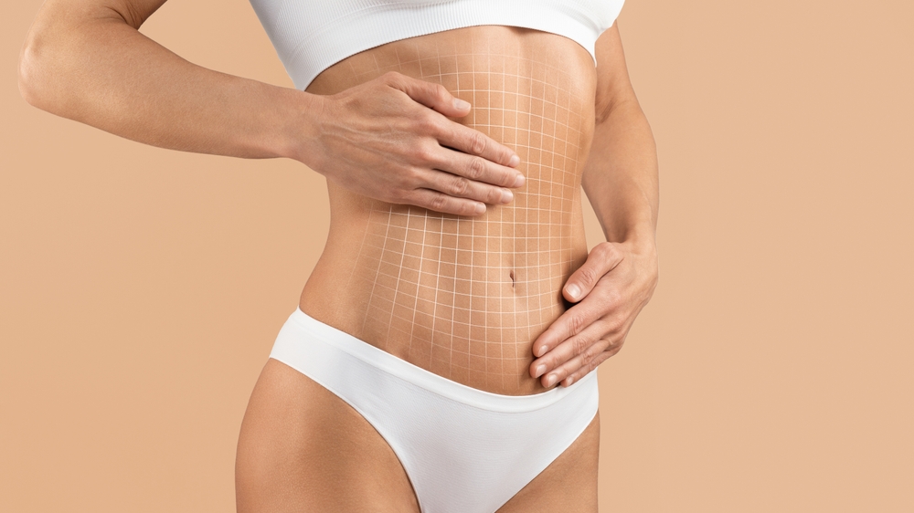 Tummy Tuck vs. Liposuction: What’s the Difference?
